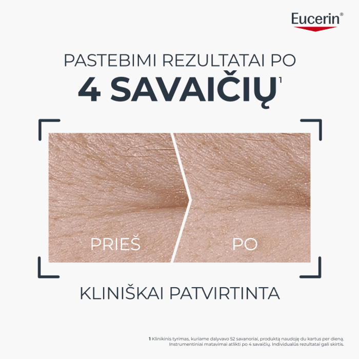 EUCERIN dieninis veido kremas su Epicelline SPF 30 HYALURON-FILLER + LONGEVITY, 50 ml-1