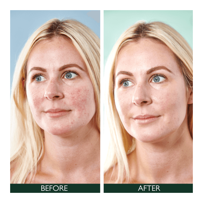 SORTED SKIN  "5 in 1" Dieninis kremas raustančiai odai SPF50, 30 ml-2