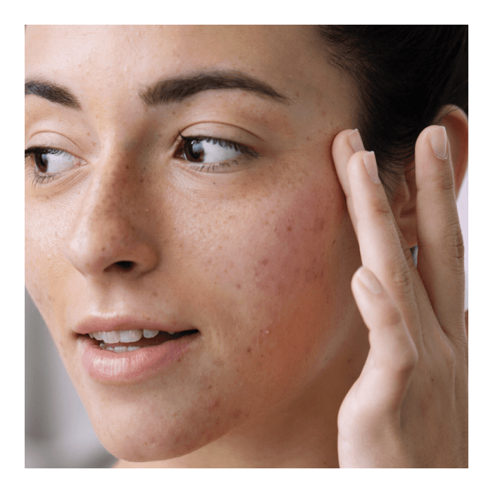 SVR veido kremas su atspalviu į aknę linkusiai odai SEBIACLEAR ACTIVE TEINTE, 40 ml, 40 ml-2