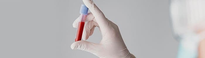 Hematokritas (HCT): norma, padidėjęs ir sumažėjęs rodiklis
