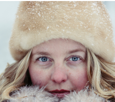 „Salcura“ – natūrali odos terapija, skirta žmonėms turintiems sausą, jautrią, alergišką odą