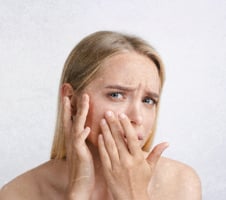 Išdygo spuogelis prieš svarbią dieną: kaip jį greitai sumažinti ar sumaniai paslėpti?