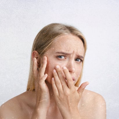 Išdygo spuogelis prieš svarbią dieną: kaip jį greitai sumažinti ar sumaniai paslėpti?