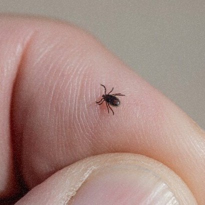 Erkės įkandimas - kaip atrodo ir kokių veiksmų imtis?